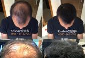 2016微商推荐产品-香港发即多，30秒头发浓密